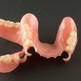 Set of upper and lower partial dentures